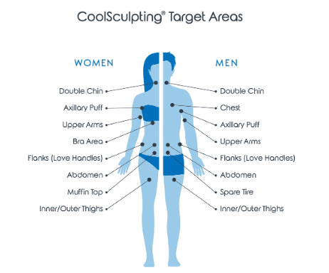 CoolSculpting Elite Chin Fat Package (save €501)