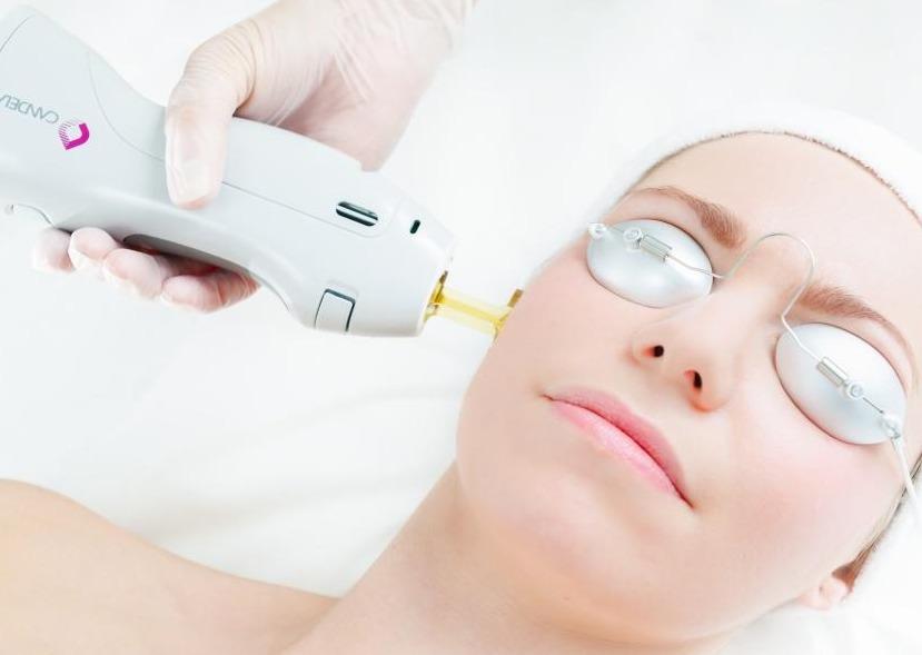 GMAX Laser skin rejuvenation for ageing, pigmentation or redness course of 4 (save €401)