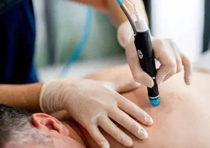 HydraFacial Back Acne Treatment Course of 3 with LED Light Therapy (save €276)